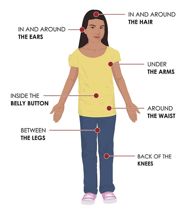 Parts of the body to check for ticks